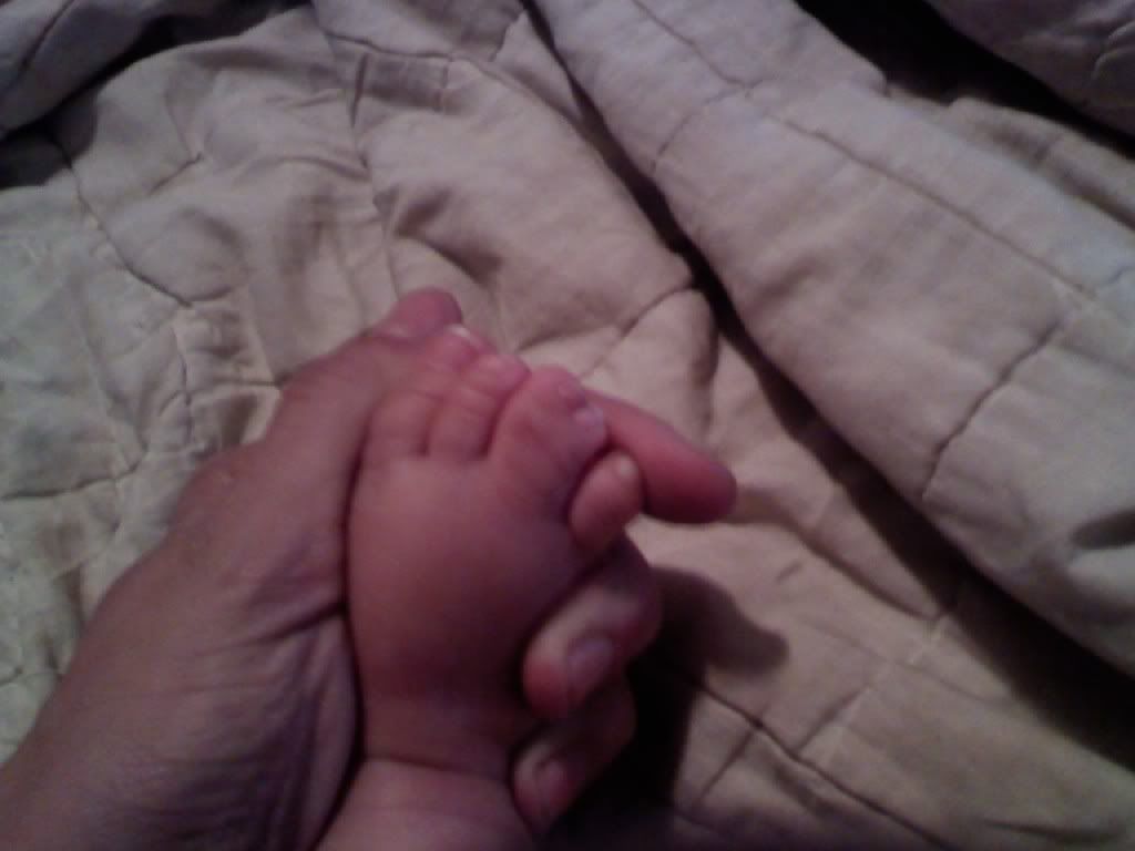 baby webbed toes