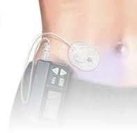 insulin pump benefits insulin pump
