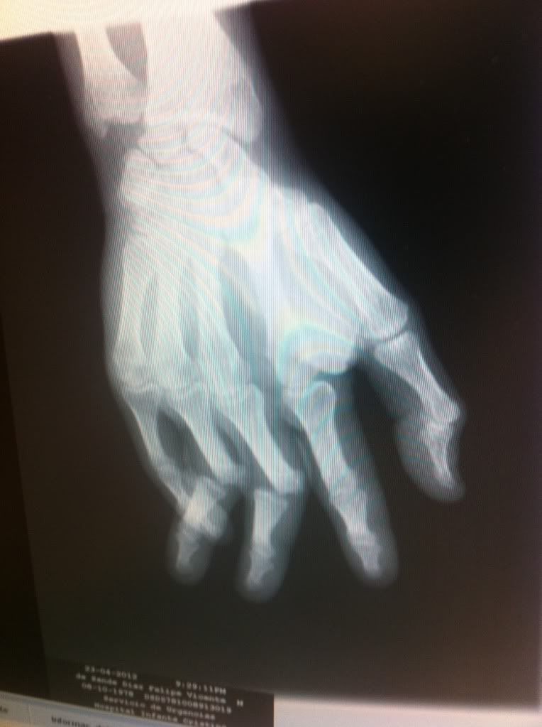 radiografia.jpg